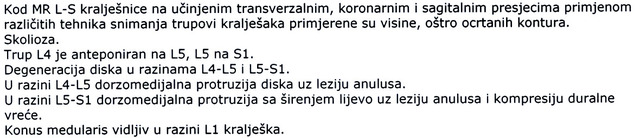 2163966-izvid.JPG